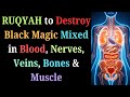 Ruqyah To Destroy Black Magic Mixed In Blood Nerves Veins Bones Muscle