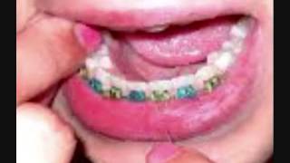 Negativland- A Most Successful Formula