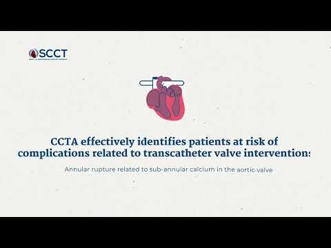 How to use cardiac CT for planning TAVR and TMVR cases: a primer for interventional cardiologists