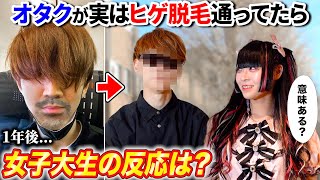 【男必見】オタクが実は1年間ヒゲ脱毛してたら、地雷系女子大生の後輩は気付くのか?【メンズ医療脱毛】byよみぃ(♪The Queen)
