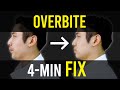 Overbite Overjet Fix Facial Asymmetry Correction Corrective Exercises