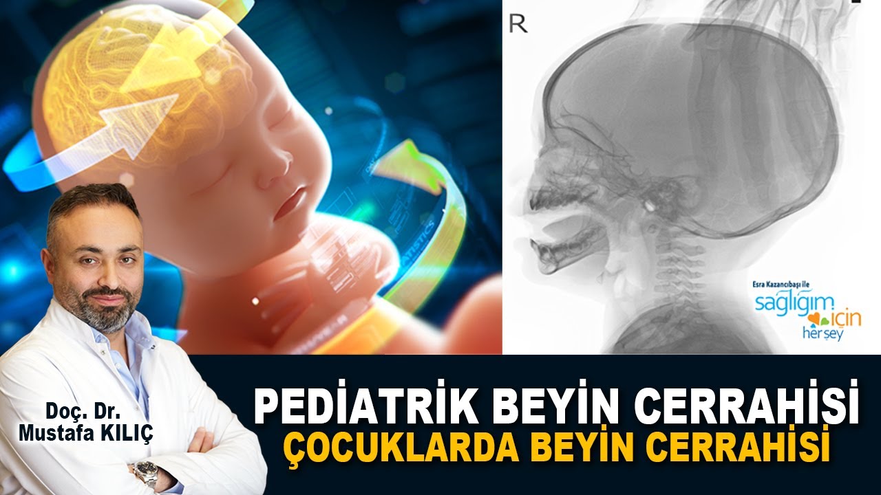 Çocuklarda ve Bebeklerde Beyin Ameliyatı Gerektiren Durumlar