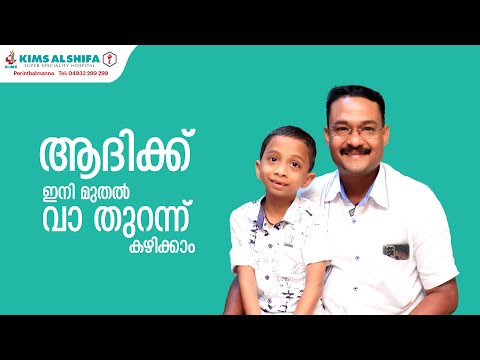 ആദിമോന് ഇനി വാ തുറന്നു ഭക്ഷണം കഴിക്കാം | TMJ Ankylosis