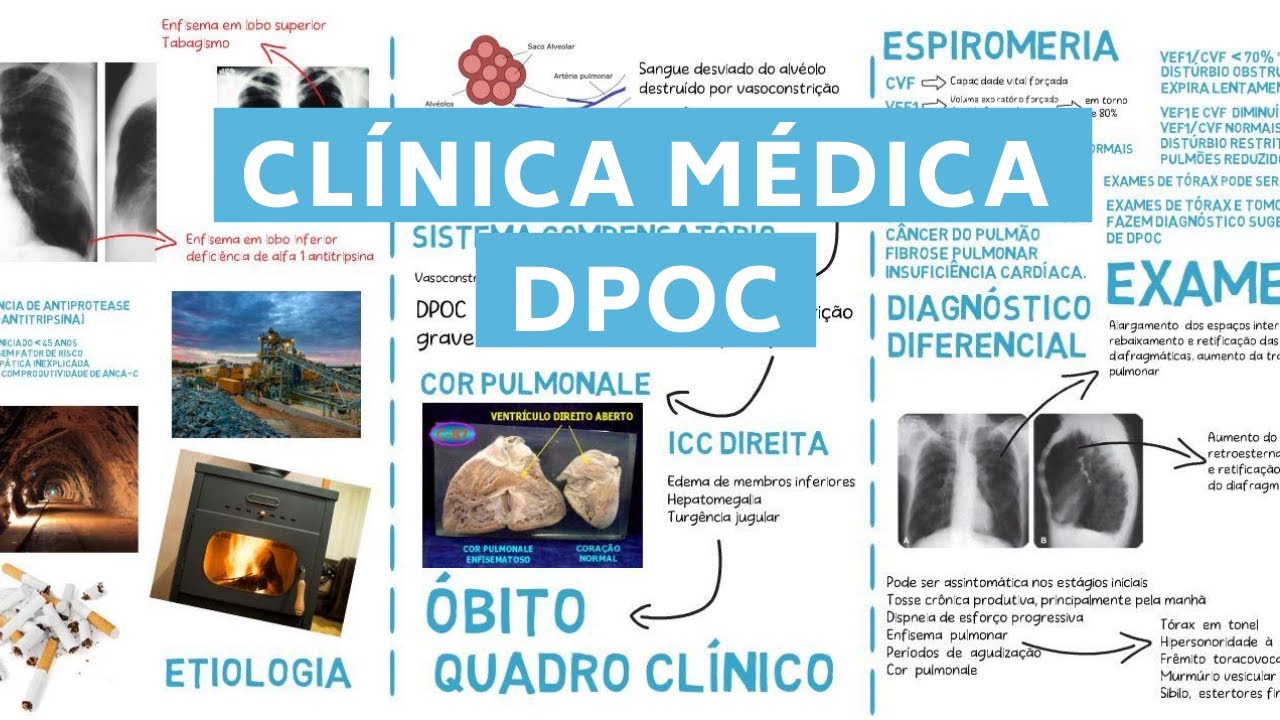 DPOC - CLÍNICA MÉDICA - DOENÇA OBSTRUTIVA CRÔNICA