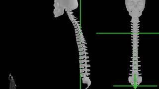 Curve Forward - Skull and Spine