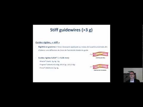 La boîte à outils (de base) moderne de l’approche antérograde