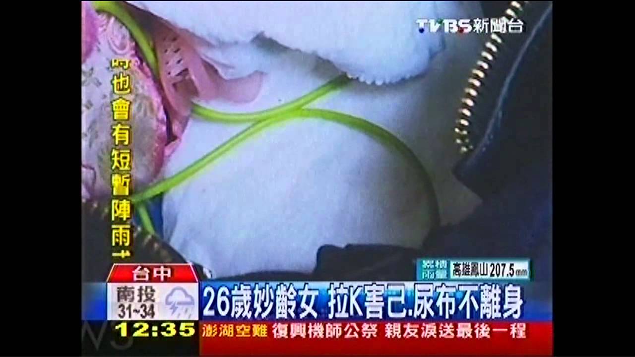 26歲妙齡女　拉K害己、尿布不離身