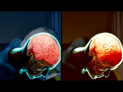 Animation: Helmet Versus No Helmet