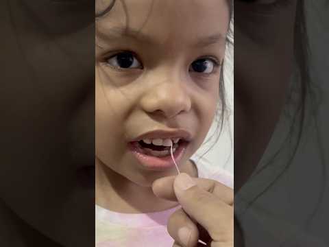 Cómo sacar un diente con hilo, al final no me dolió 😅 #diente #sacardiente