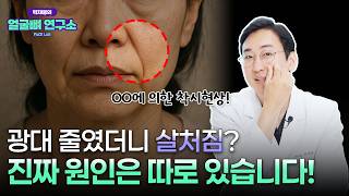 광대축소수술 후 무조건 살처짐 볼처짐? 원인과 해결책 총정리!