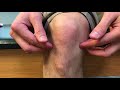 Knee Pain Types Explained | Royersford, PA | Limerick, PA