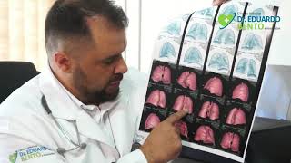 Dr. Eduardo Bento explica como a evolução da covid-19 afeta o pulmão