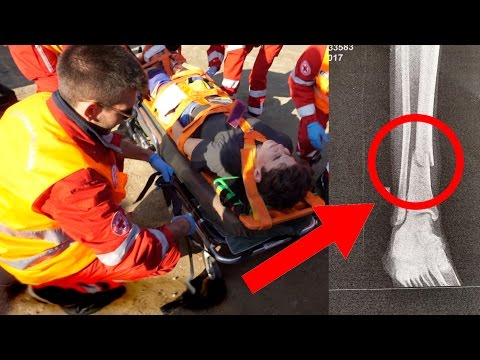 Mal di schiena quando si piega in avanti Vitamine per la colonna vertebrale in osteocondrosi in prodotti