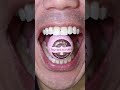 ASMR Venchi Chocolate DoctorTristanPeh ASMR Chocolate