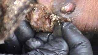 John with BIG, LOOSE Jiggers ( 1 0f 2)