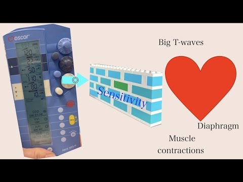 Temporary pacemakers 101: Sensitivity