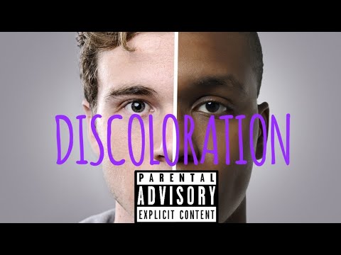 Video thumbnail for DISCOLORATION