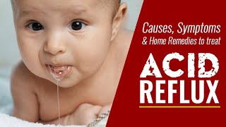 How to Treat Acid Reflux in Babies | Home Remedies for Acid Reflux.