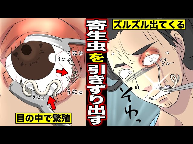 漫画 目の中で大量の寄生虫を飼っていた男 目の中で大きく育った寄生虫をズルズルと引きずり出した結果 新闻 Now 漫画 目の中で大量の寄生虫を飼っていた男 目の中で大きく育った寄生虫をズルズルと引きずり出した結果 新闻 Now
