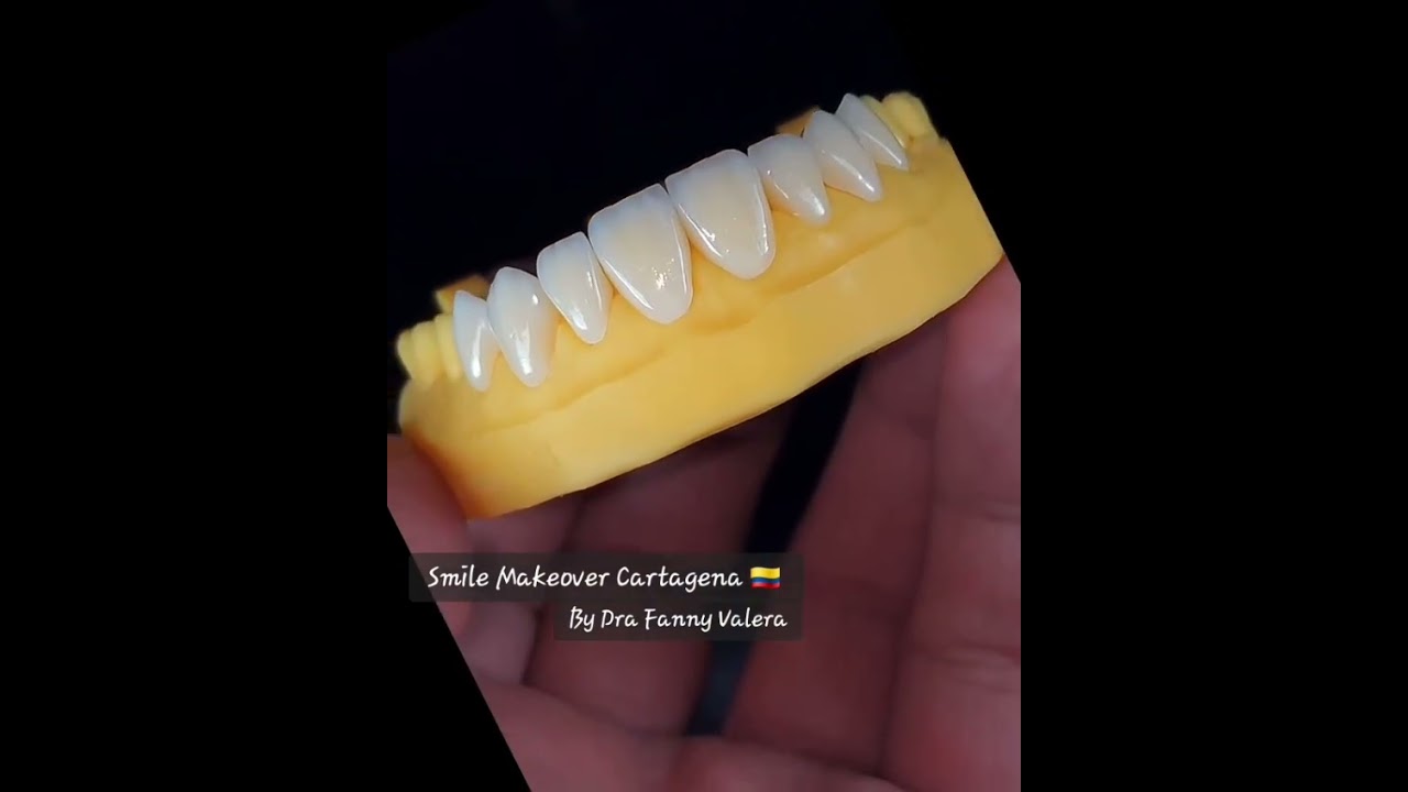 Fanny Valera Velásquez-136