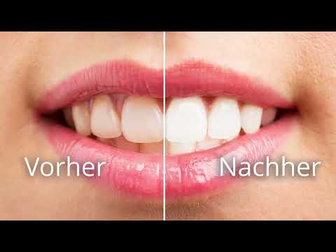 Bleaching Germany - kosmetische Zahnaufhellung um bis zu 9 Nuancen präsentiert von SHR Germany GmbH