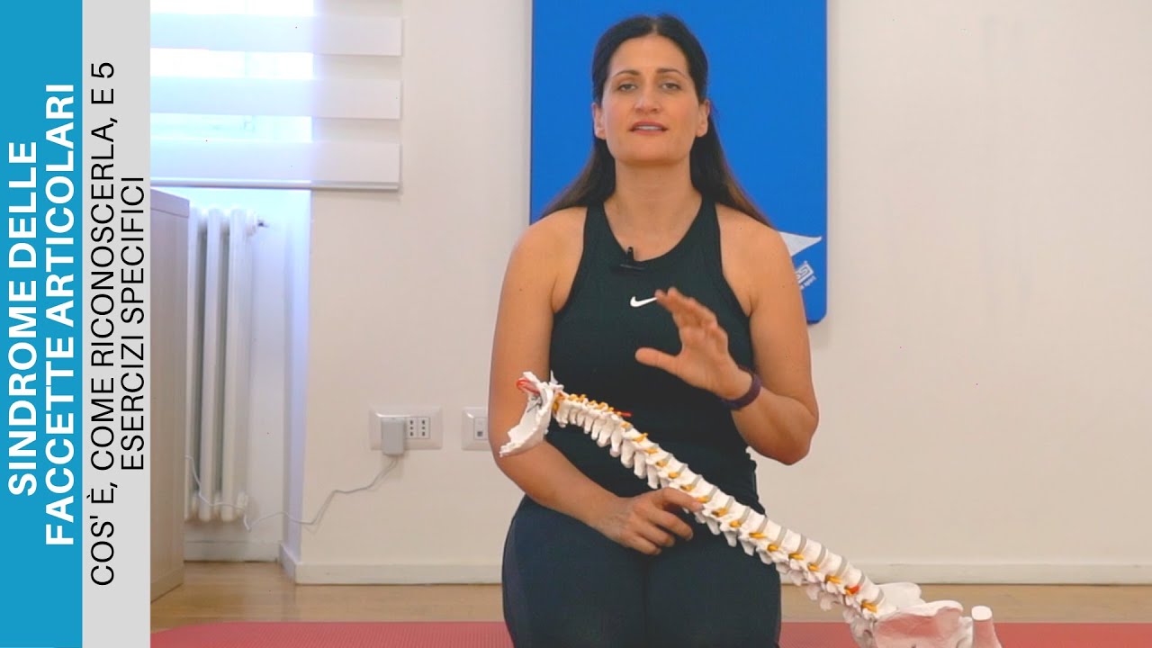 Sindrome delle FACCETTE ARTICOLARI: Cosa è, come riconoscerla, e 5 esercizi SPECIFICI