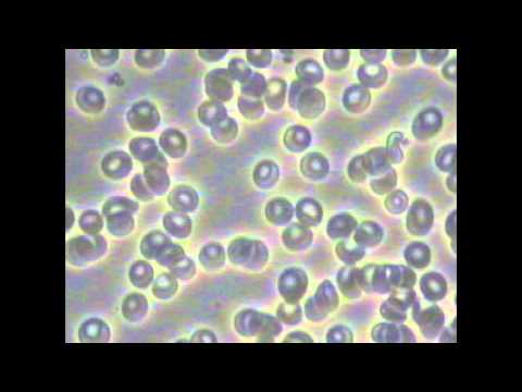 CCC0150091 @2015.10.29 before/after photos