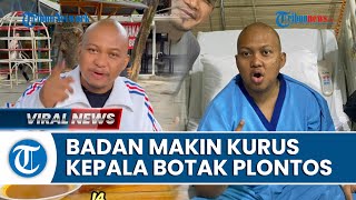 POTRET Babe Cabita Sebelum Meninggal Dunia: Badan Tampak Kurus dan Kepalanya Botak Plontos