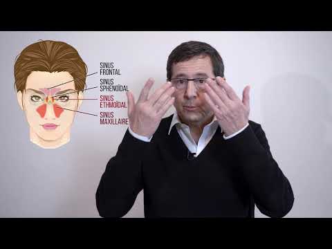 Sinusite chronique : Quand dois-je me faire opérer ?