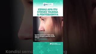 Kenali Apa itu Stroke Telinga, Penyakit yang Bisa Picu Tuli Permanen