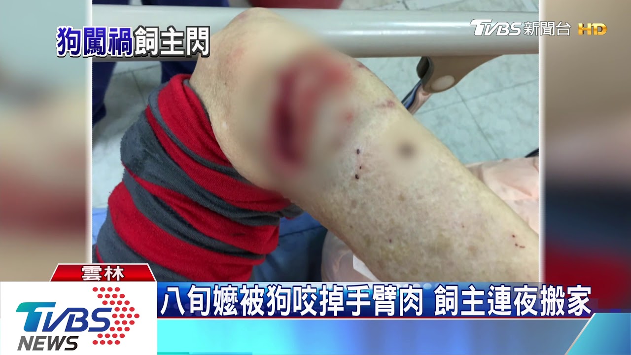 八旬嬤被狗咬掉手臂肉 飼主連夜搬家