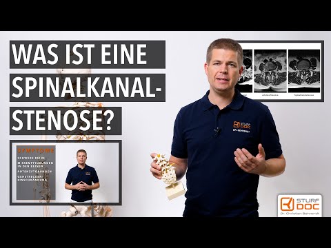 Spinalkanalstenose - Teil 1: Von der Ursache bis zur Erkrankung - Rollator früh verhindern!