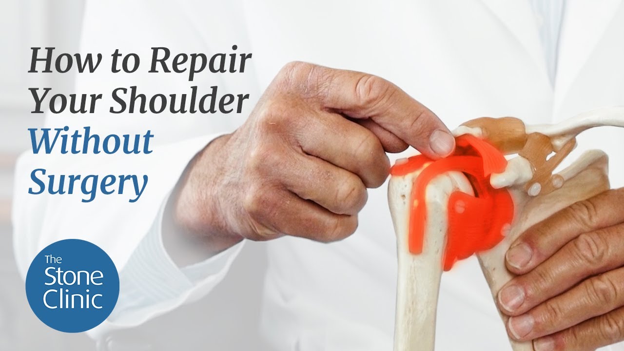 Can shoulder instability be fixed without surgery?