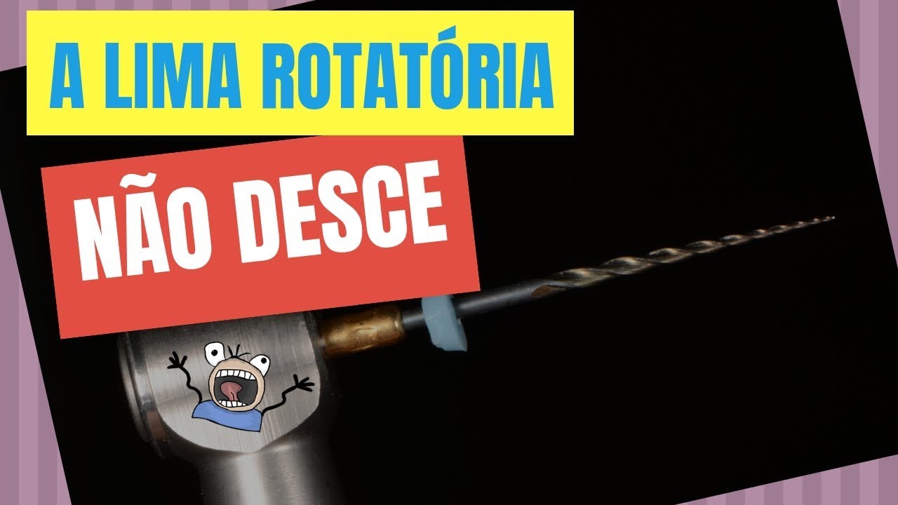 O QUE FAZER QUANDO A LIMA ROTATÓRIA NÃO DESCE? - QUICK TIP ENDOLOVERS