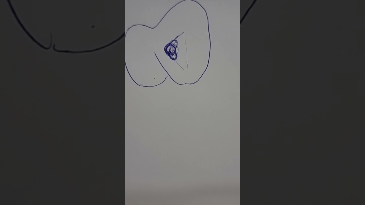 The Endo task. ADC part 2