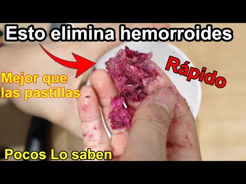 Este Remedio Te Ayudará a Eliminar Las Hemorroides Para Siempre