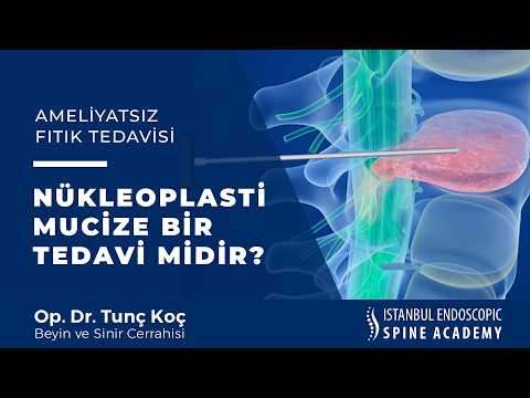 Nükleoplasti Mucize Bir Tedavi Midir? Video