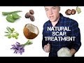 Alex's DIY All Natural Scar Treatment Tutorial ...