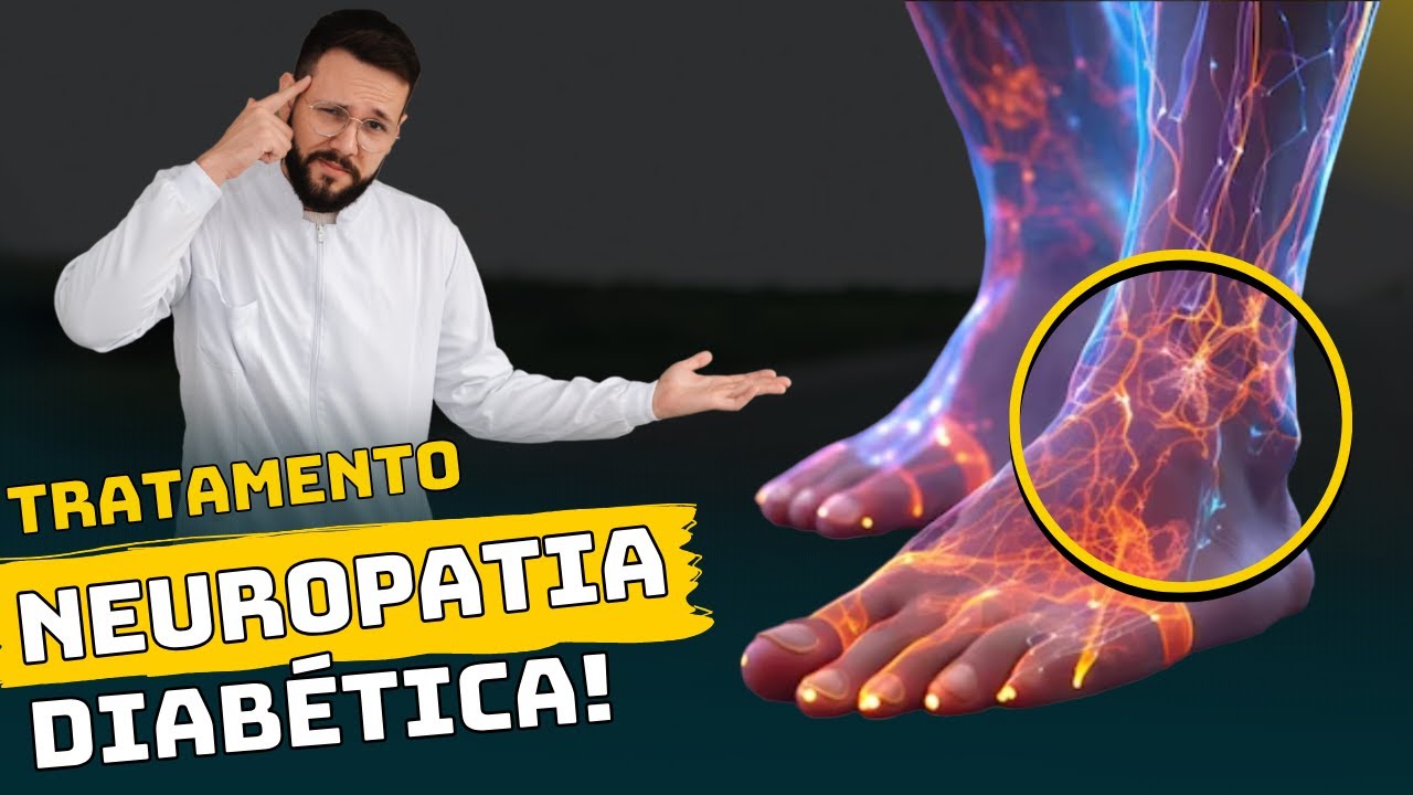 Tratamento Caseiro da Neuropatia Periférica [dor nos nervos das pernas e pés]