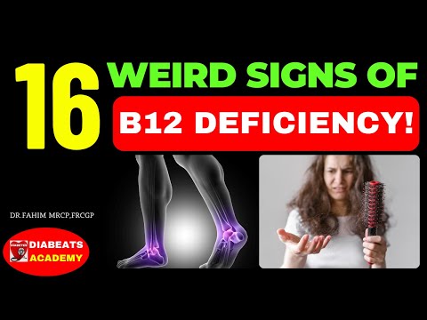 WARNING TOP 16 Signs and Symptoms of Vitamin B12 Deficiency! (YOU MUST KNOW AND ACT QUICKLY)