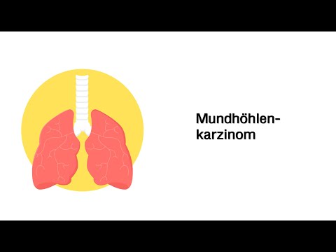 Mundhöhlenkrebs (Mundhöhlen- und Larynxkarzinom) - Erkrankungen der Atemwege