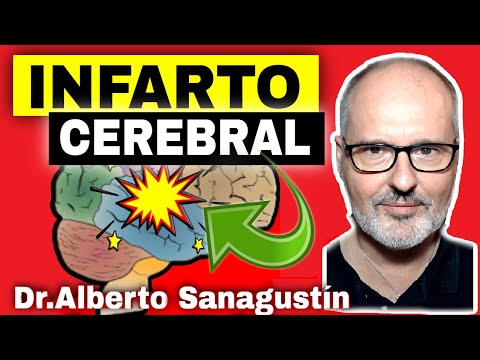 BRAIN INFART (STROKE) Causes, Symptoms, Treatment and Prevention