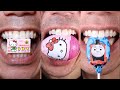 Must See Chewing ASMR By Doctor Tristan Peh