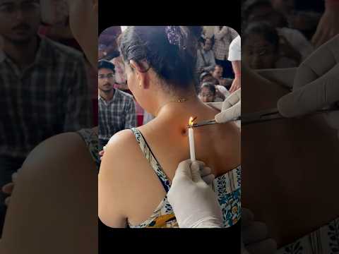 Bams-bachelor of ayurvedic medicine and surgery 🩺 #shorts #ytshorts