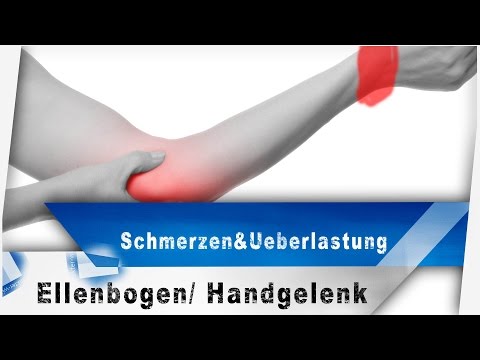 Taub Fingerspitzen auf der Hand Osteochondrose Lilac Tinktur auf Alkohol für Gelenke