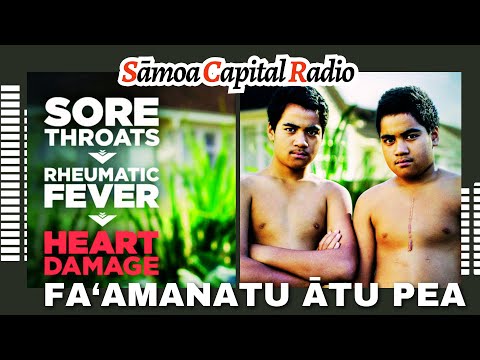 FA'AMANATU ĀTU PEA - Rhematic Fever - Sāmoa Capital Radio