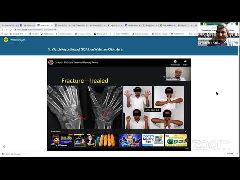 Webinar 26 Demystify Scaphoid -Master Class