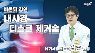 [비온뒤 강연] 내시경 디스크 제거술