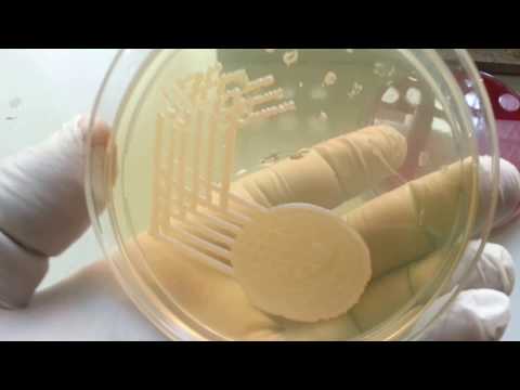 klebsiella pneumoniae tünetei férfiaknál