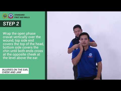 INJURIES ON THE EAR CHEEK JAW